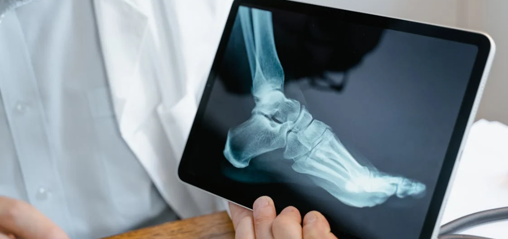 Orthopedics billing services in California